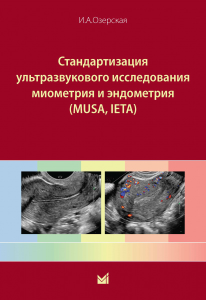 ОзерскаяНов