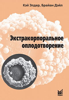 Экстракорпоральное оплодотворение